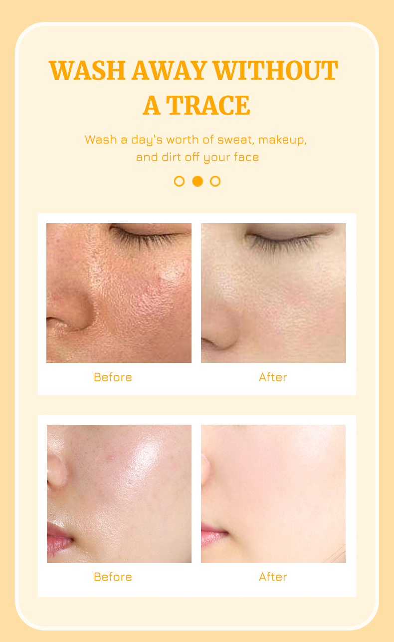 Facial Cleansing Foam